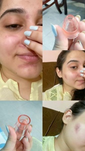 Post cover