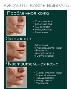 Post cover